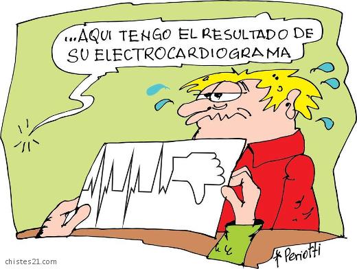 Electrocardiograma